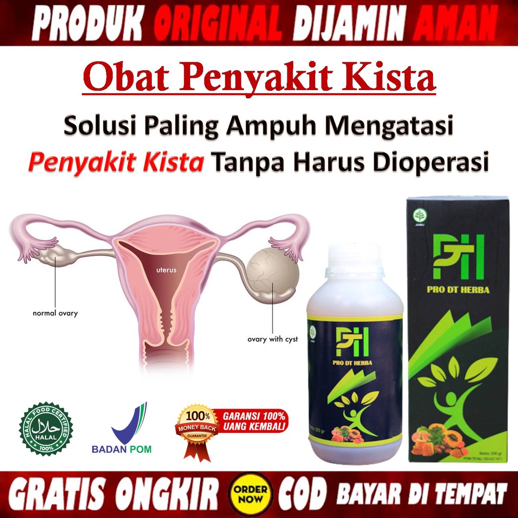 Obat Miom Alami - Obat Miom Dan Promil - Obat Miom Dan Kista - Obat Miom Herbal - Obat Miom Uterus -