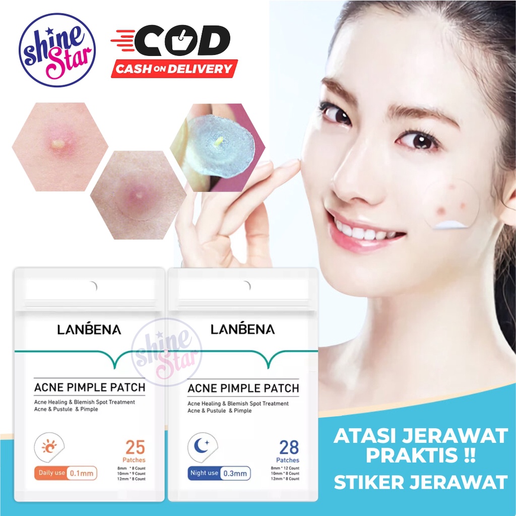 SHINE STAR - [ COD ] ANTI ACNE PIMPLE PATCH DAY N NIGHT / OBATI JERAWAT TANPA DI PENCET DAN BEKAS