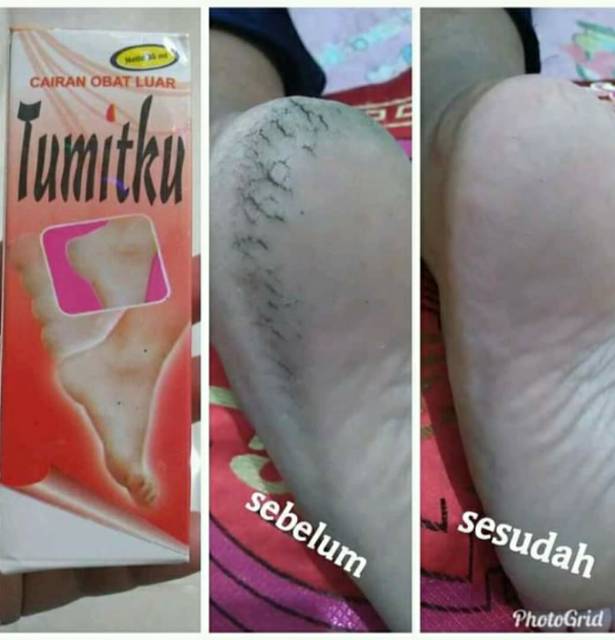 Tumitku
