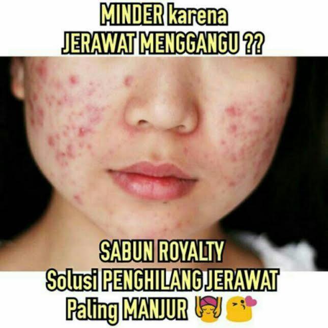Sabun Muka Penghilang Bekas Jerawat Untuk Pria Wanita Alami