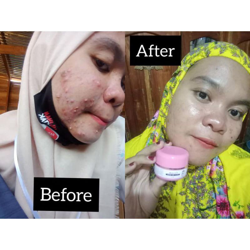 CREAM ALL IN ONE WASILA COSMETIK