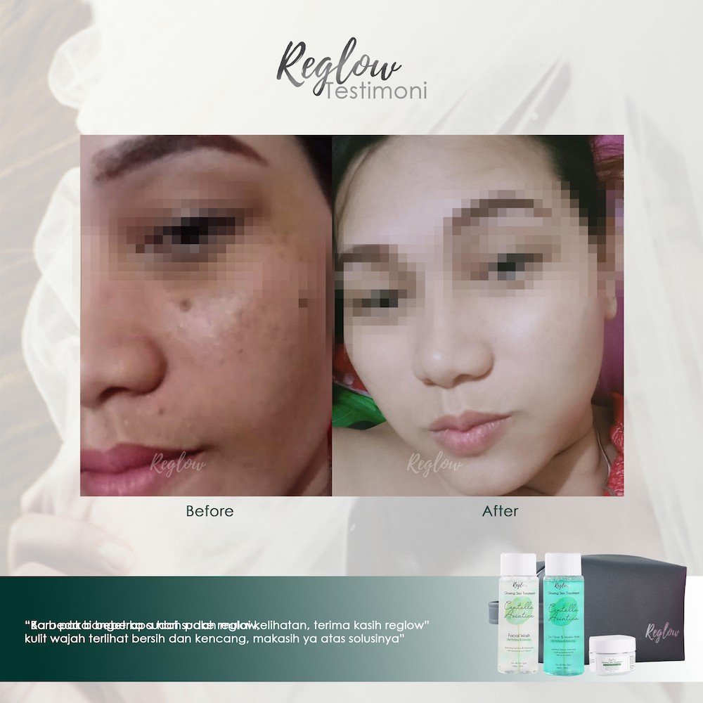 FACIAL WASH REGLOW RE GLOW ACNE PENGHILANG BEKAS JERAWAT SIMPLE SKINCARE BPOM REGLOW