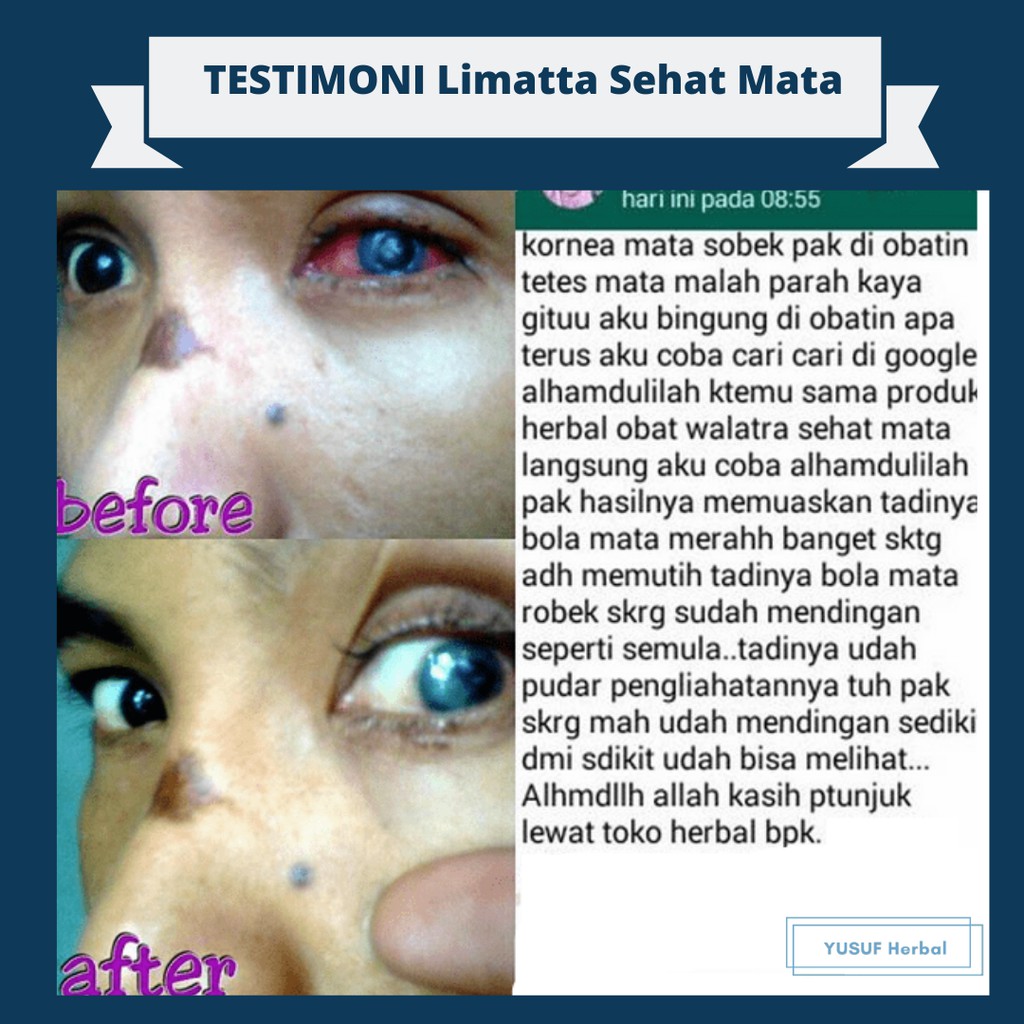 Sehat Mata Limatta Original Spesialis Obat Penyakit Mata Legalitas Bpom Berkualitas Unggul Indonesia