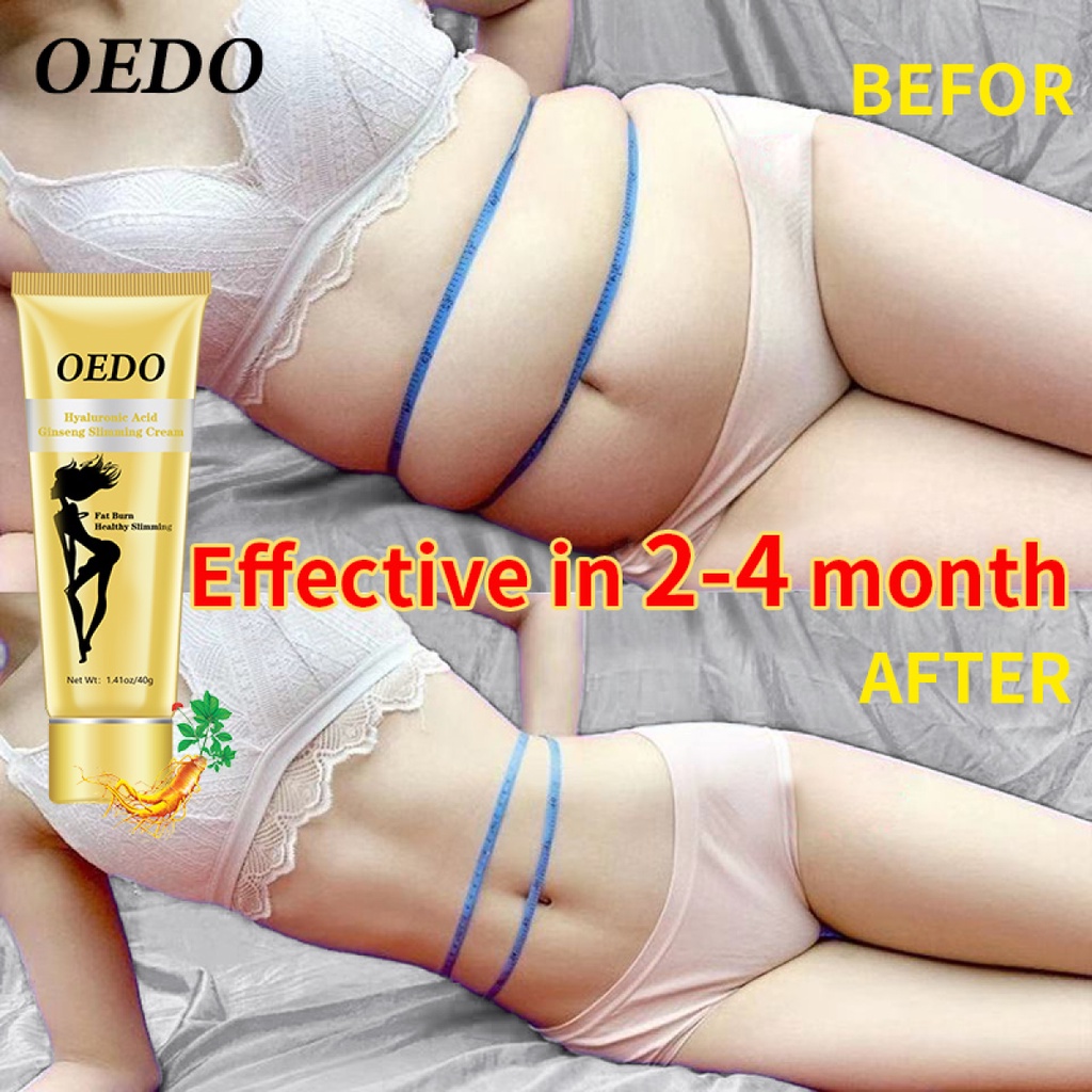 OEDO Hyaluronic Acid Ginseng Slimming Cream Reduce Cellulite Lose Weight Burning Fat Slimming Cream