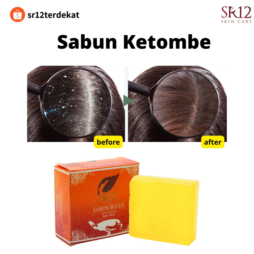 Sabun Ketombe Sr12