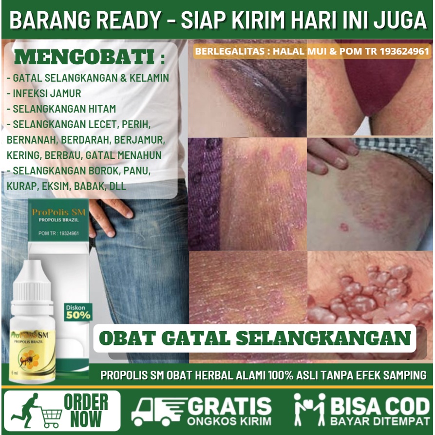 Obat Alami Penghilang Selangkangan Hitam & Kering Akibat Gatal Jamuran, Obat Oles Gatal Infeksi Jamu