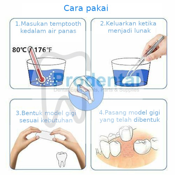 Temptooth / Gigi Palsu / Lem Gigi Padat / Gigi Veneer Buat Sendiri