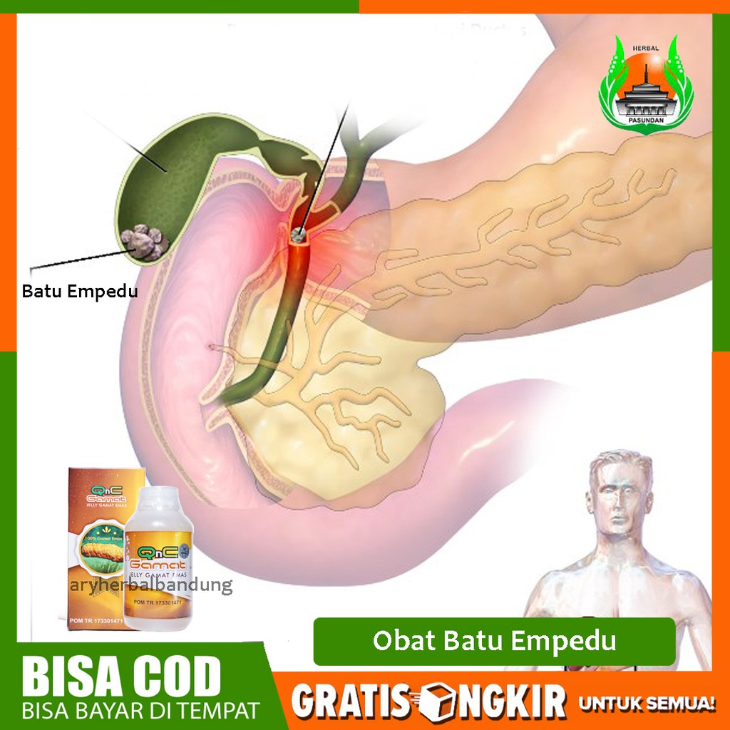 Obat Batu Empedu Sakit Perut Di Sebelah Kanan Atas Herbal Alami Qnc Jelly Gamat Asli Legal Bpom Shopee Indonesia