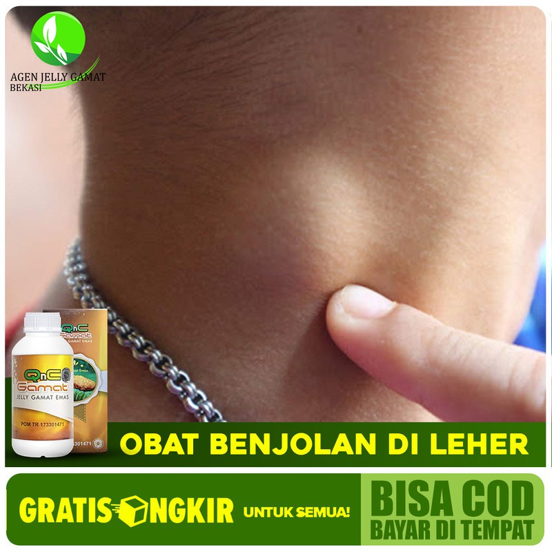 

Obat Benjolan Di Leher, Gondok, Hipertiroid, Tiroid Herbal QnC Jelly Gamat Di Bekasi Bisa COD