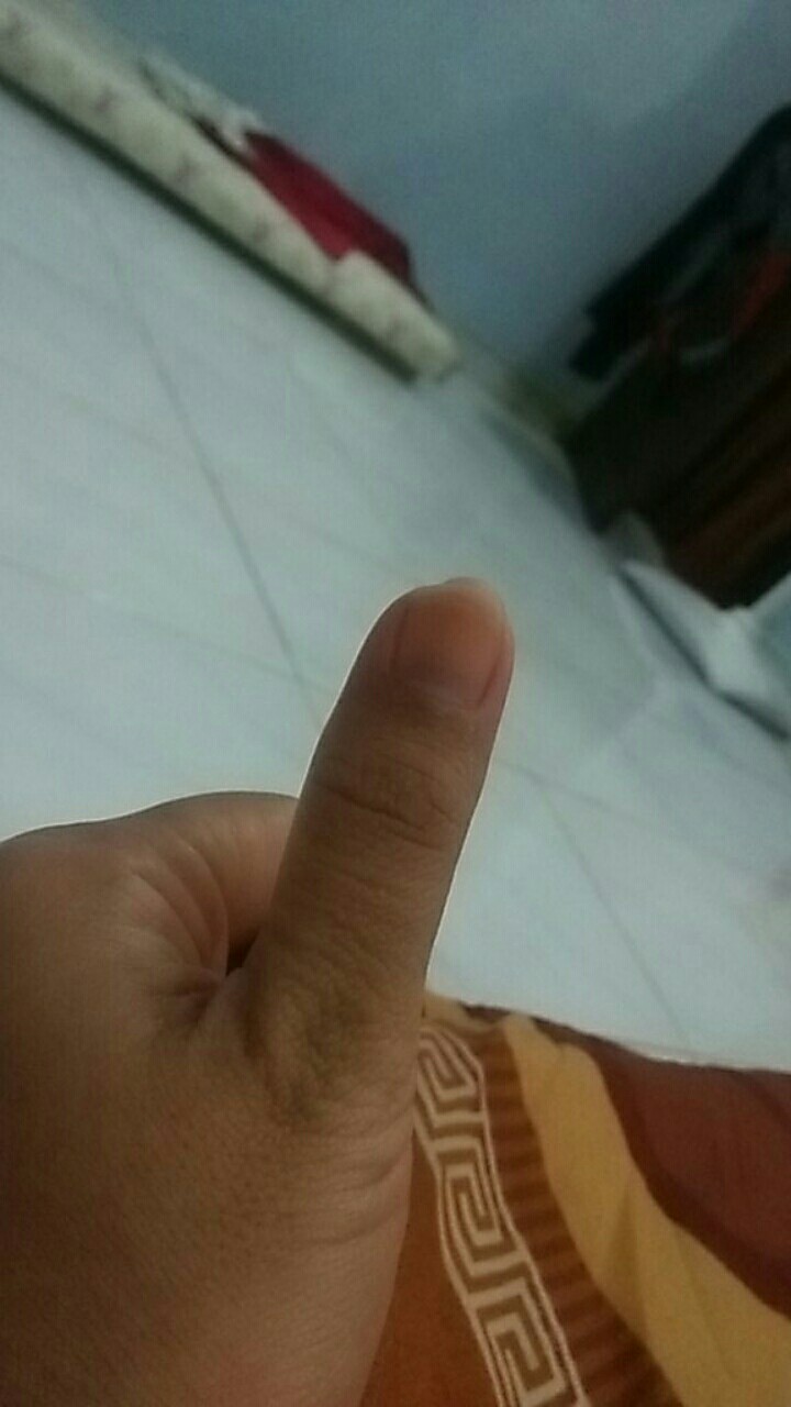 Kompor Gas Rinnai 522e 2 Tungku Bodi Bahan Stanles Steel Anti Karat