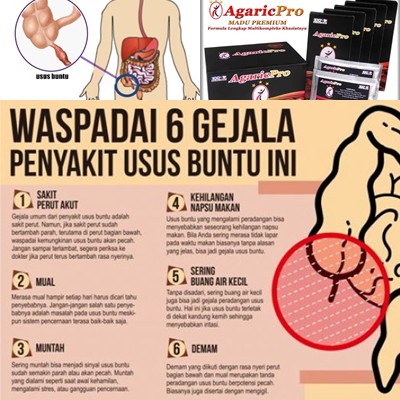 Obat Herbal Usus Buntu Kronis Ampuh Tanpa Operasi Shopee Indonesia