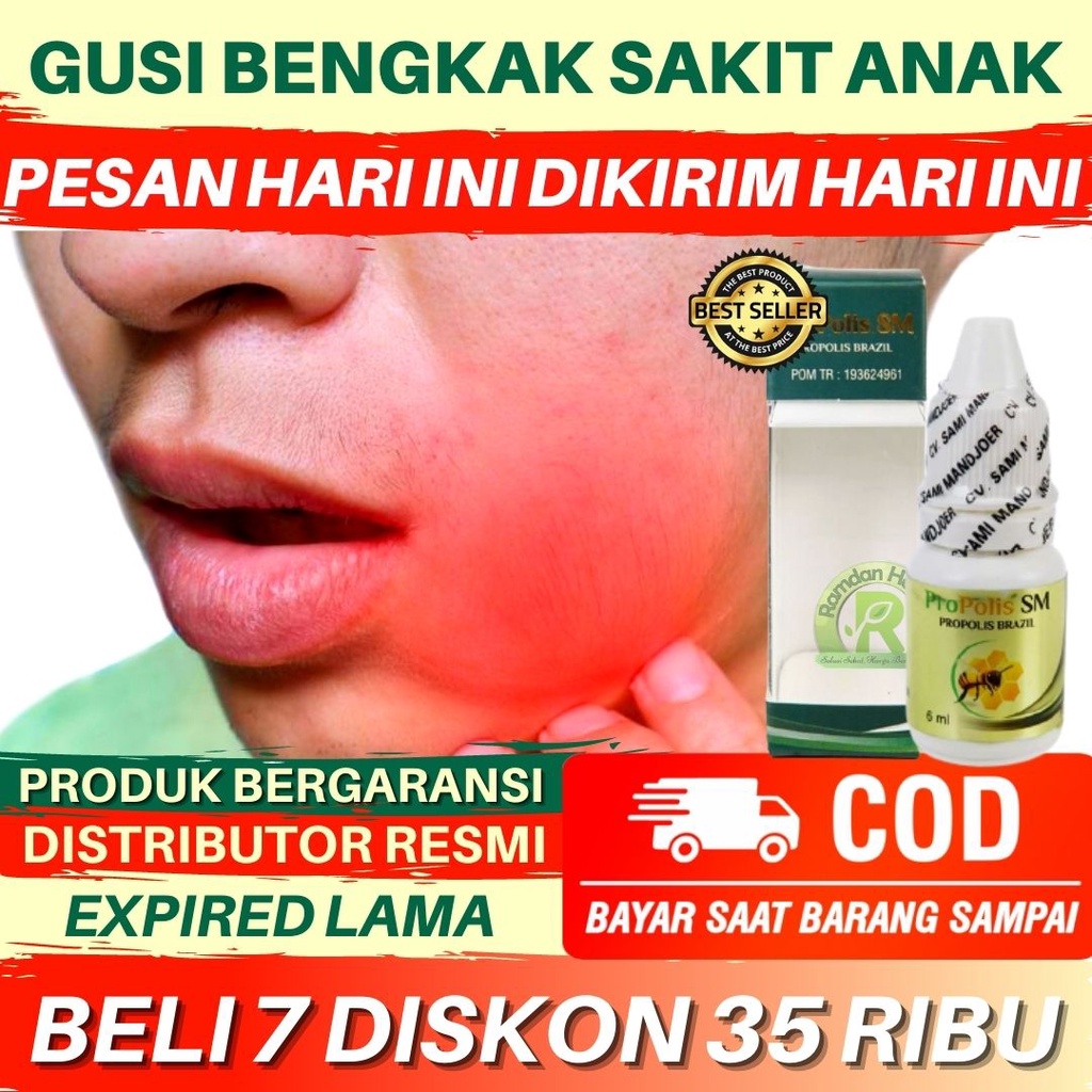 Obat Gusi Bengkak Sakit Untuk Anak Gusi Bernanah Anak Gusi Berdarah Anak Polip Gusi Anak Radang Gusi