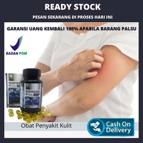 Obat Penyakit Kulit Alami, Kulit Gatal, Jamur, Kurap, Kusta, Budug, Borok Bio Squalene 30 Softgel