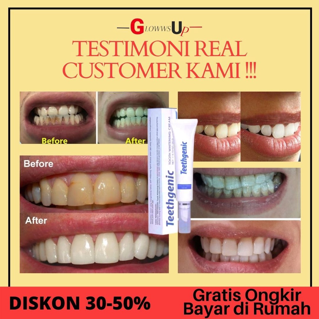 Pemutih Gigi Kuning Teethgenic Tooth Whitening Cream By Ertos Cream Pemutih Gigi Perwatan Gigi