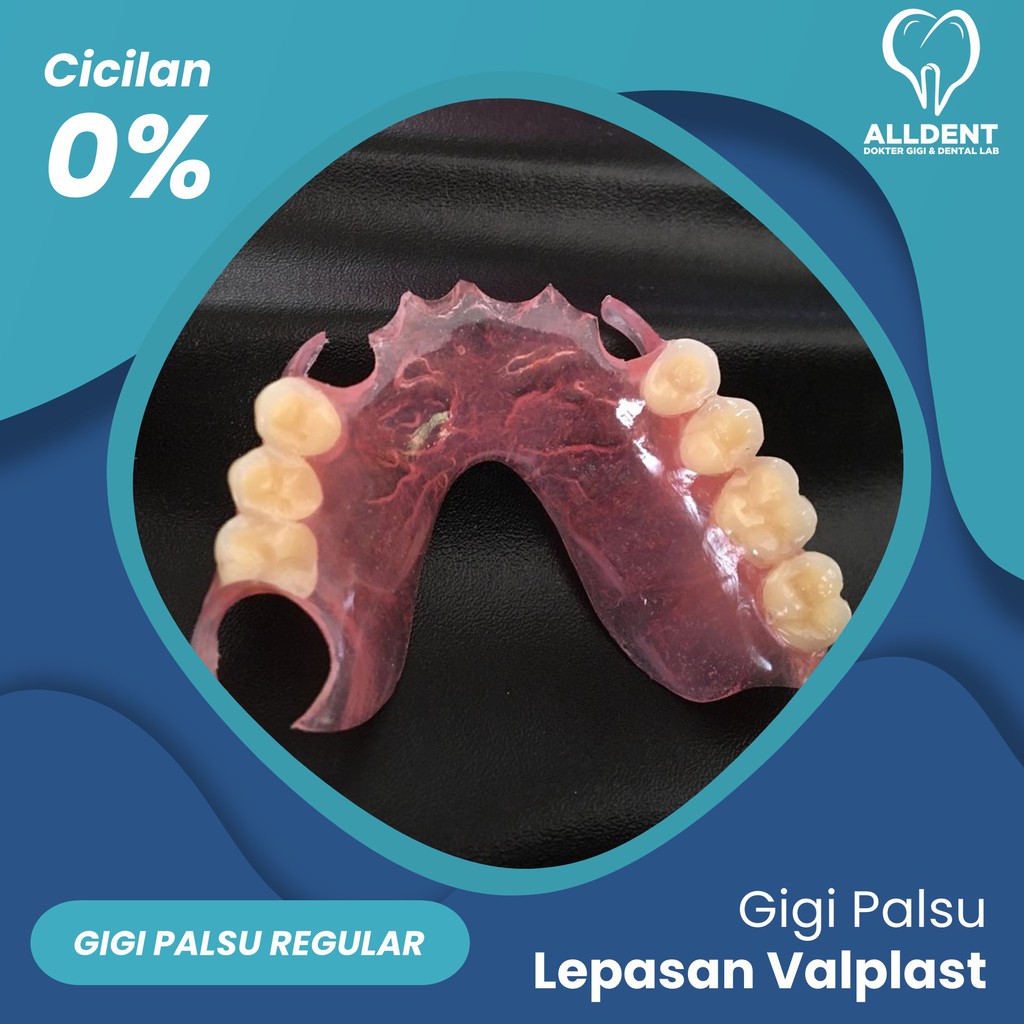 GigI Palsu Lepasan Valplast