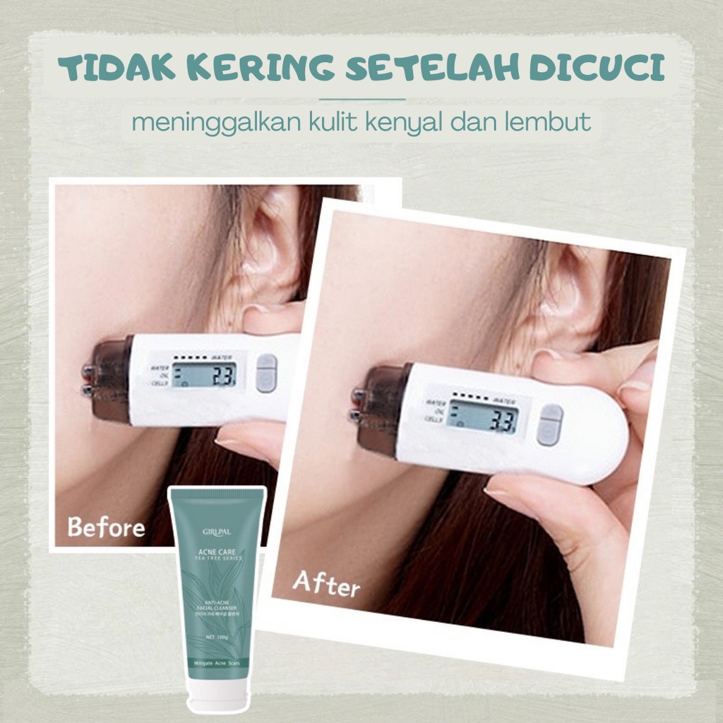 Girlpal Tea Tree Anti Acne Facial Foam Cleanser Fasial Wash Tea Tree Acne Treatment Foam Pembersih Wajah Muka Jerawat Komedo Hidung Dan Berminyak Bpom