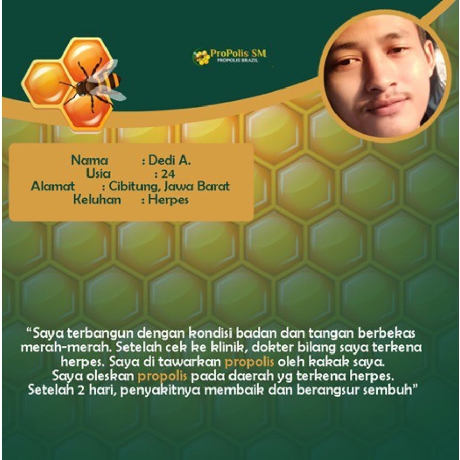 Obat Oles Penghilang Benjolan Kecil / Bintik - Bintik / Bruntusan di Alat Vital Pria, Obat Oles Alam