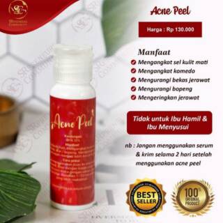 DAHSYAT! Jerawat langsung kering Acne peel SR12 Herbal anti ...