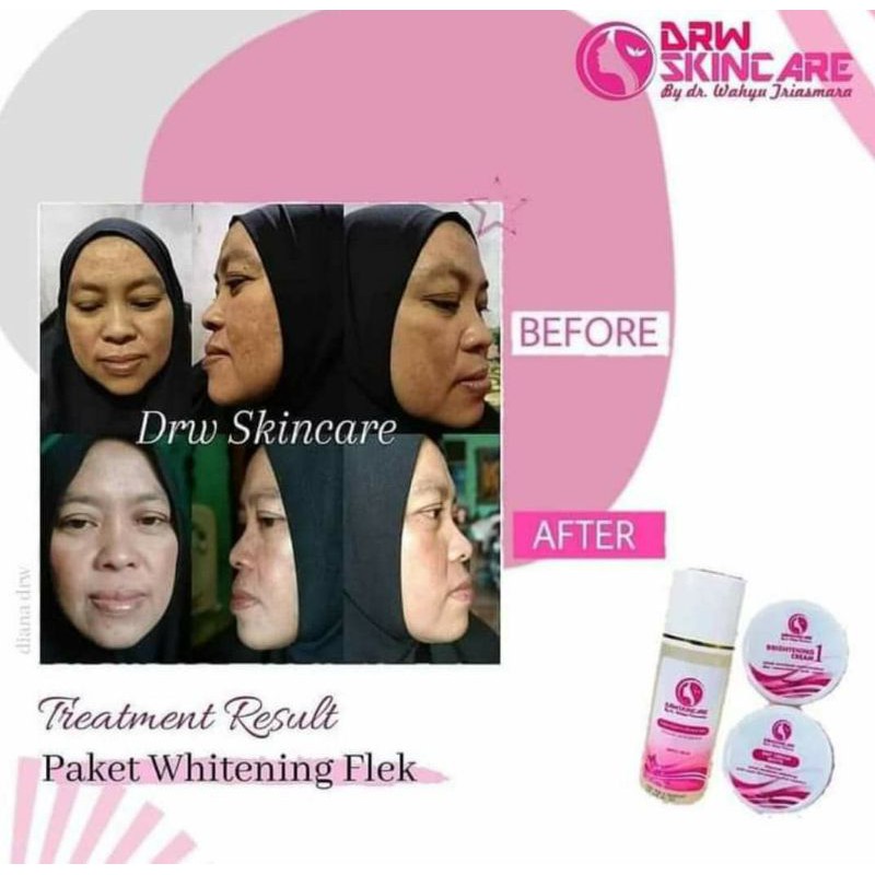 Paket whitening flek drw skincare