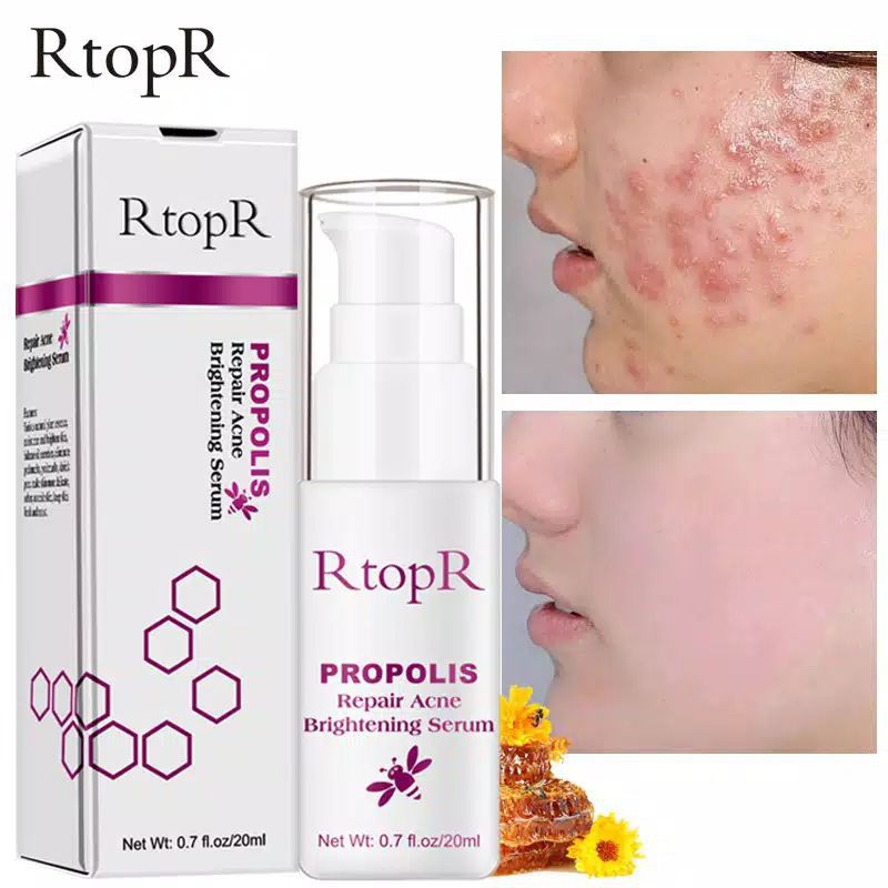 RtopR Propolis Repair Acne Shine Serum