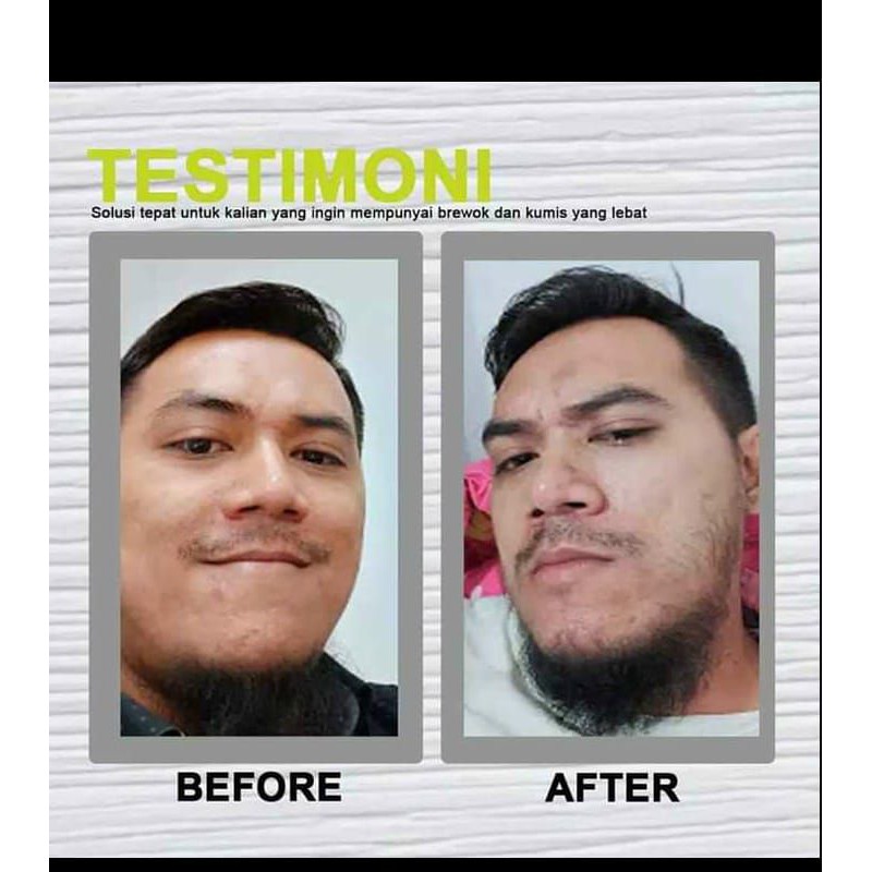 HORMON PENUMBUH ALIS/BRWEOK/KUMIS DAN RAMBUT PALING CEPAT AMPUH