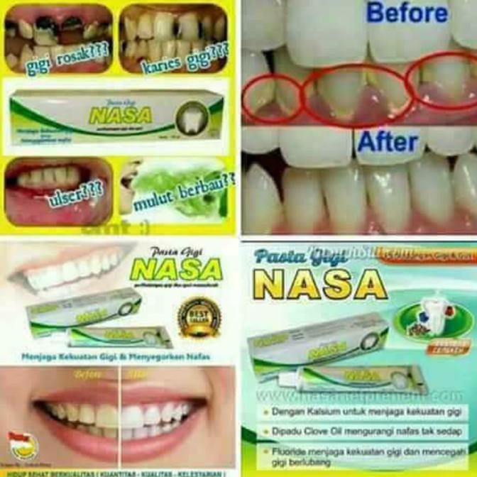 Pastagigi Nasa/ Odol Gigi Nasa/ Odol Nasa