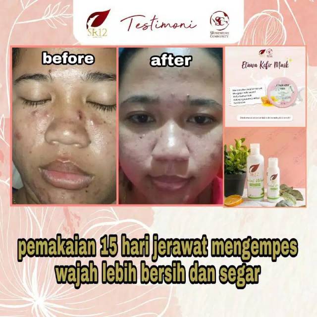 SABUN WAJAH GREENTEA SR12 / FACIAL WASH KULIT NORMAL / BERMINYAK / BERJERAWAT