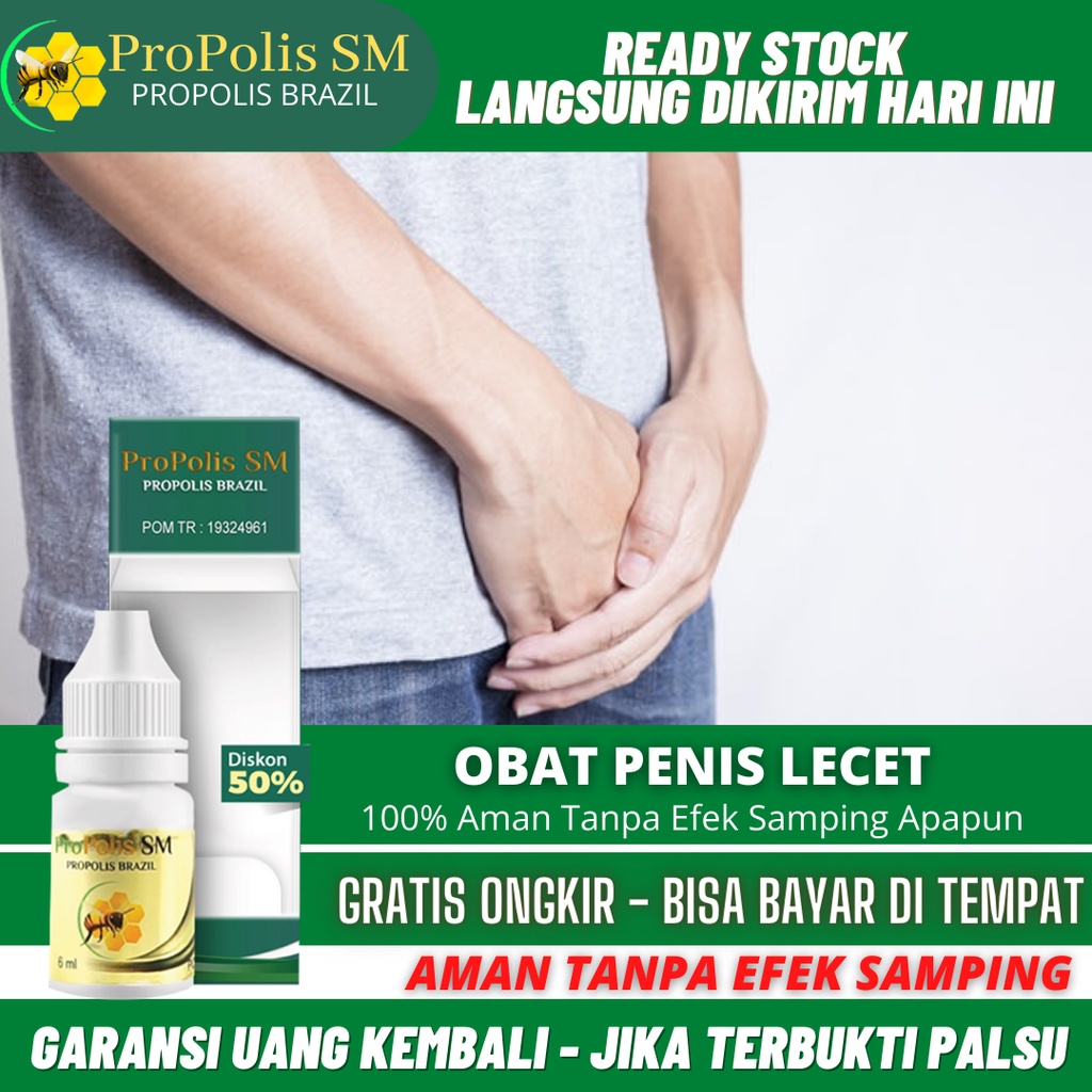Obat Kelamin Pria Lecet, Obat Penis Bentol, Salep Luka Di Penis, Batang Kelamin Luka, Ruam Merah, Pe