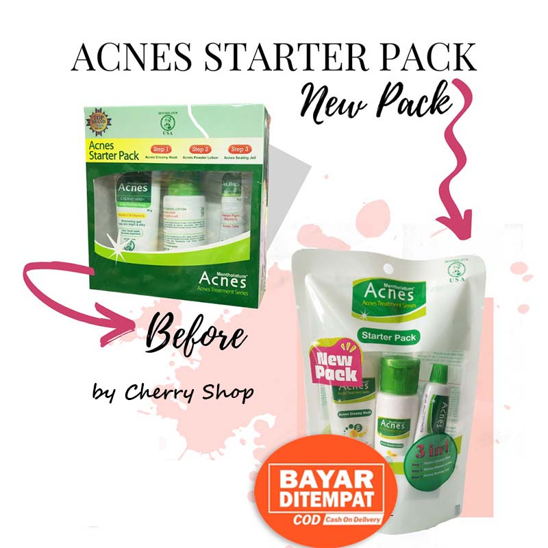 [NEW] [BPOM] ACNES Starter Pack 3 In 1 - Creamy Wash 20GR | Powder Lotion 20ML | Sealing Jell 5GR