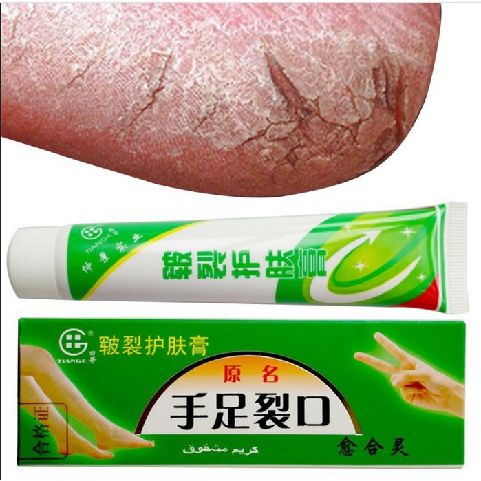 GOOD QUALITY Hand Foot Crack Cream Penghalus Tumit Pecah Pecah