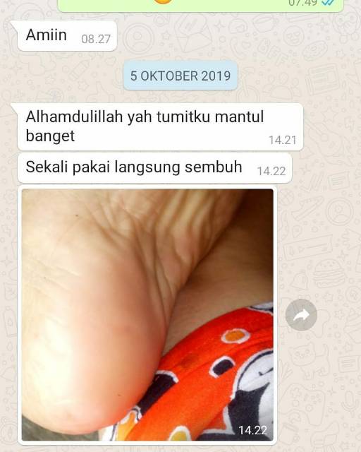 OBAT KAKI PECAH DAN KERING TUMIT TUMITKU ORIGINAL 30ML BPOM AMPUH