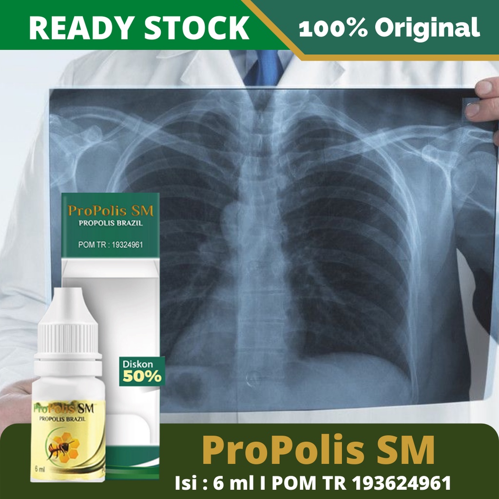 Obat Paru Paru, Flek Paru Paru, Basah Bronkitis, Suplemen Kesahatan, Obat Tradisional Penyakit Paru Paru, Kanker Paru Paru, Pneumonia, TBC Paru, TB Batuk, TB Aktif, Psoriasis – ProPolis SM 100% Herbal Alami BPOM Tanpa Efek Samping