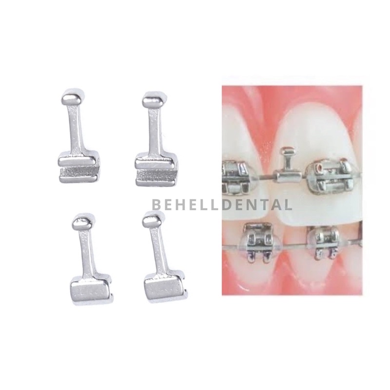 BEHELLDENTAL DENTAL SLIDING CRIMPABLE HOOK ORTHO SHORT LONG - Crimpables Hook Antena Kecil Orthodontic 2mm 3mm - Orthodontics Behel Bracket Braces Kawat Gigi Original ANTI KARAT