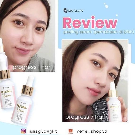 V-29 MS glow Peeling serum ꕤ