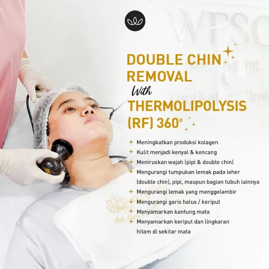Thermolipolysis (RF) 360 | Pipi Tirus | Double Chin | Perut Langsing