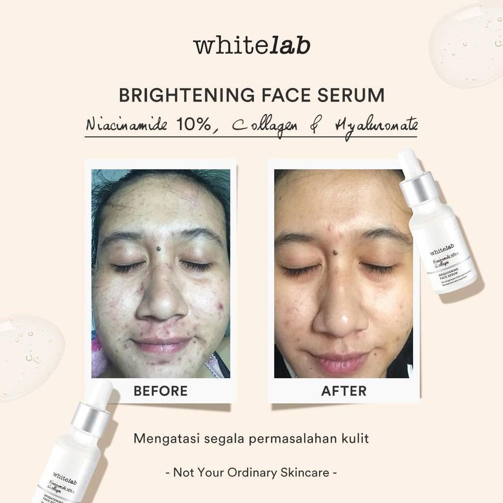 Whitelab Brightening Face Serum - Nicianamide 10%