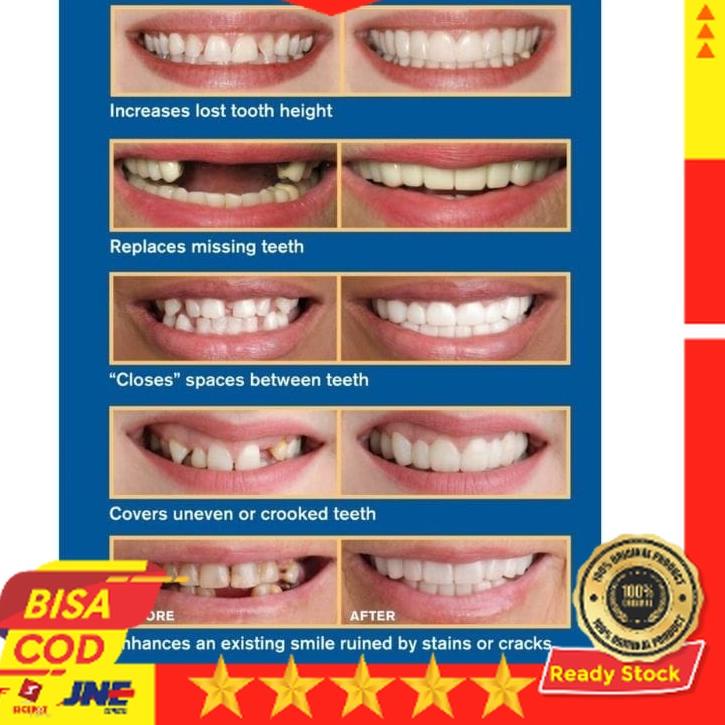 Hot Sale Snap On Smile Gigi Palsu 100% Original Asli /Gigi Palsu venner - Gigi Palsu Silikon 1 Set