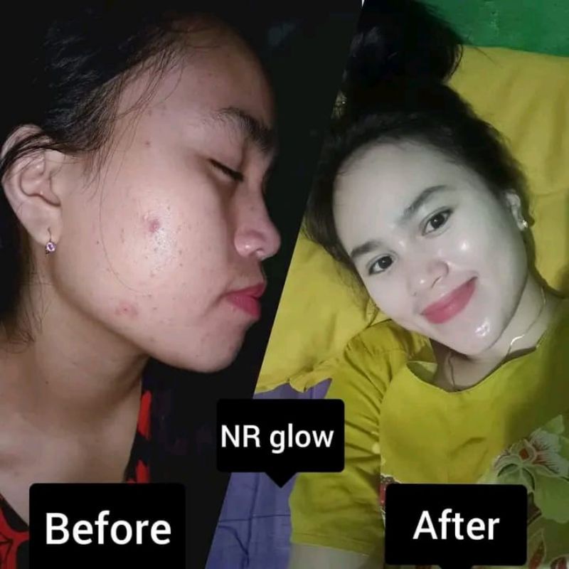 PAKET SKINCARE/PELICIN PEMUTIH WAJAH NR GLOW/DOBEL GLOW (menghilangkan flek+lebih cepat putih)