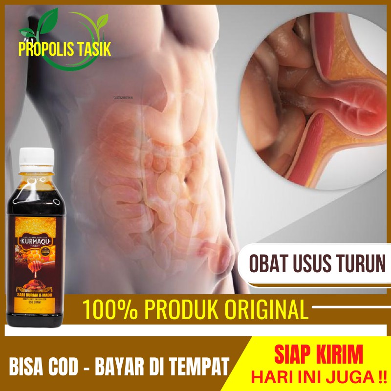 Obat Usus Turun, Hernia, Turun Berok, Infeksi Usus, Usus Buntu, Radang Usus - Usus Burut KURMAQU