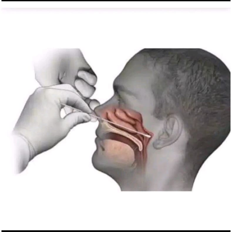Test Swab Antigen mandiri / Alat Test