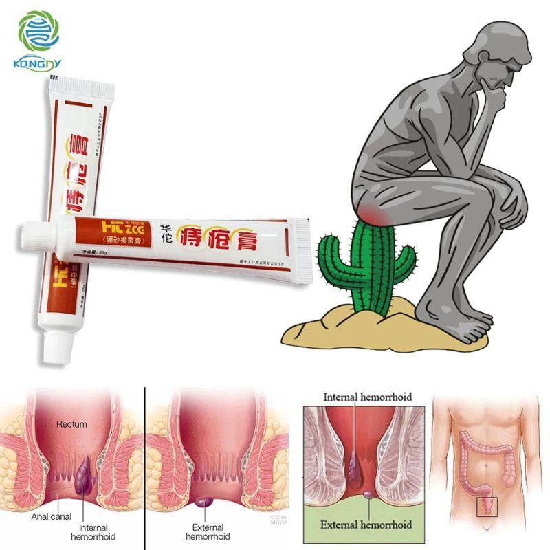 Huatuo 100% Original Obat wasir herbal ampuh ambeyen ambien ambian ambeien hermorrhoids cina alami