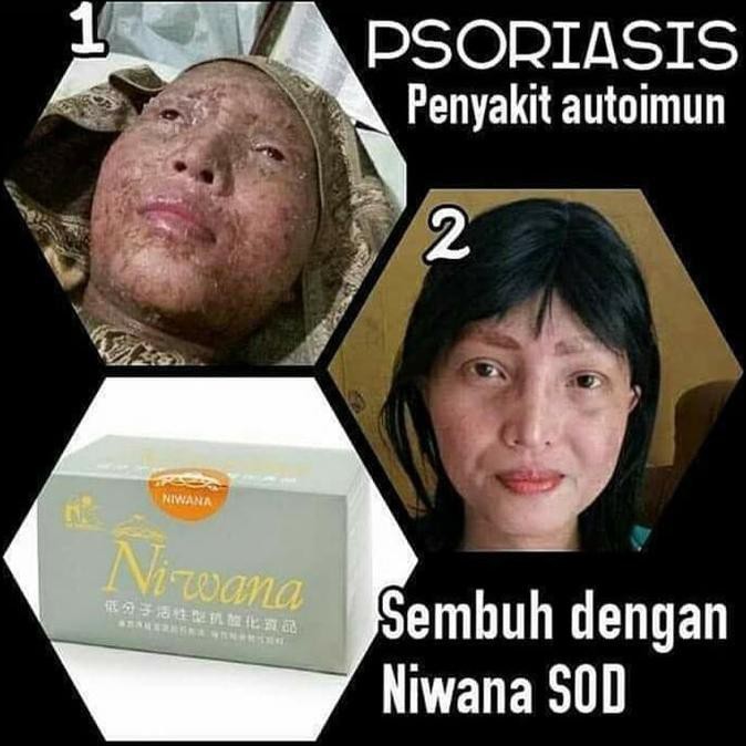 Paket Hemat Niwana Sod 3 Box • Kk Indonesia • Ori 100% •