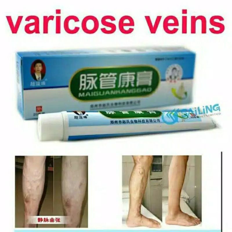 [ bisa COD] ~ SALEP PENGHILANG VARISES TRADITIONAL CHINA VARICOSE VEINS ORIGINAL