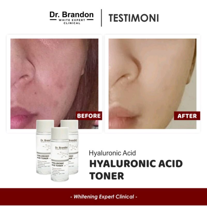 Dr. Brandon HYALURONIC ACID TONER (With Hyaluronic Acid 5%) 60ml