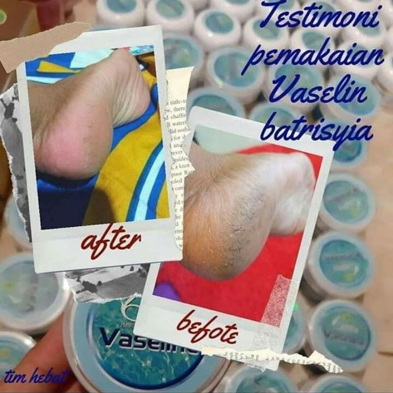 ( BISA COD ) VASELINE UNTUK KAKI PECAH PECAH/ CREAM TUMIT AMPUH/ CREAM KAKI PECAH PECAH