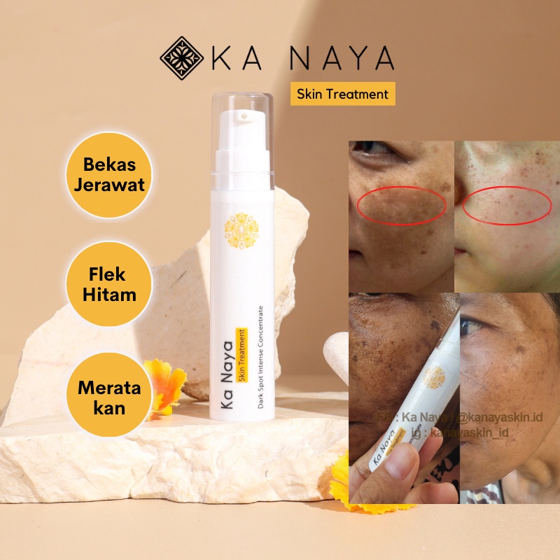 Ka Naya Dark Spot Intense C. Night Whitening Salep Flek Hitam - Penghilang Bekas Jerawat - serum bek