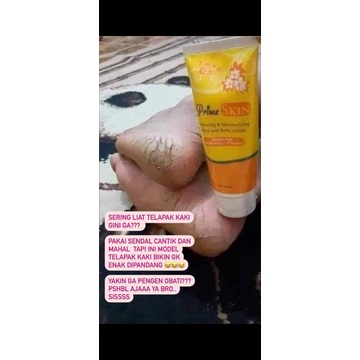 hand body prime skin hwi - penghilang bekas luka