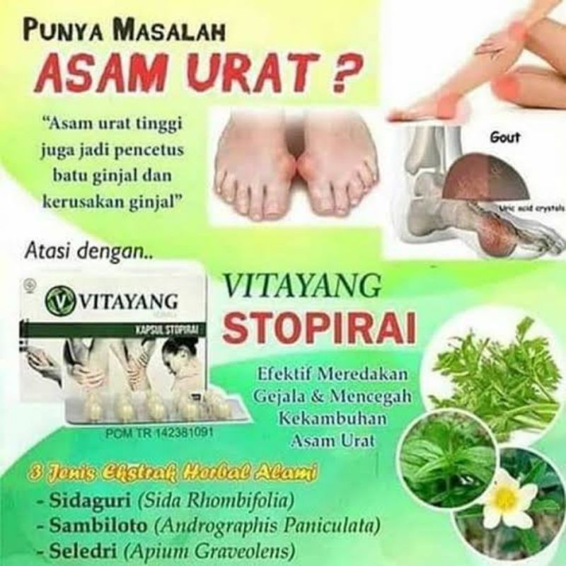 

Vitayang Stopirai Asam Urat