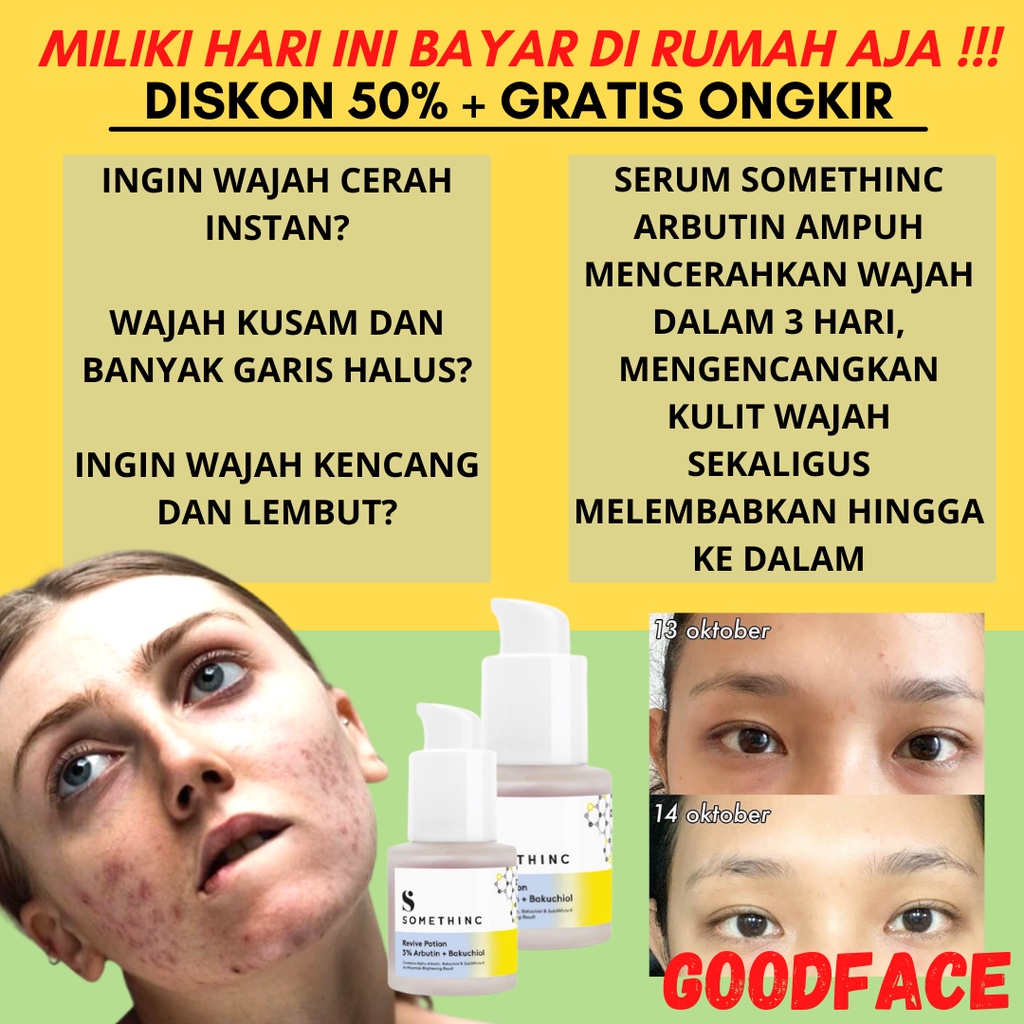 Serum Jerawat Dan Bruntusan SOMETHINC Revive Potion 3% Arbutin + Bakuchiol