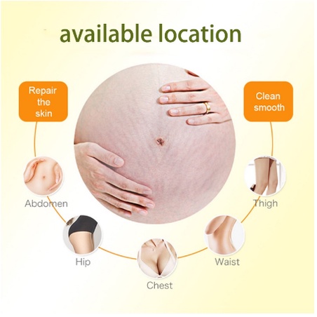 Penghilang strechmark Krim stretch mark Strecth Mark Cream 30ml Krim Perawatan Pascapersalinan Krim Hilangkan Garis-Garis Lemak Menghilangkan Strech Mark Menghilangkan Garis-Garis Lemak Pada Perut, Paha Dan Pantat-5